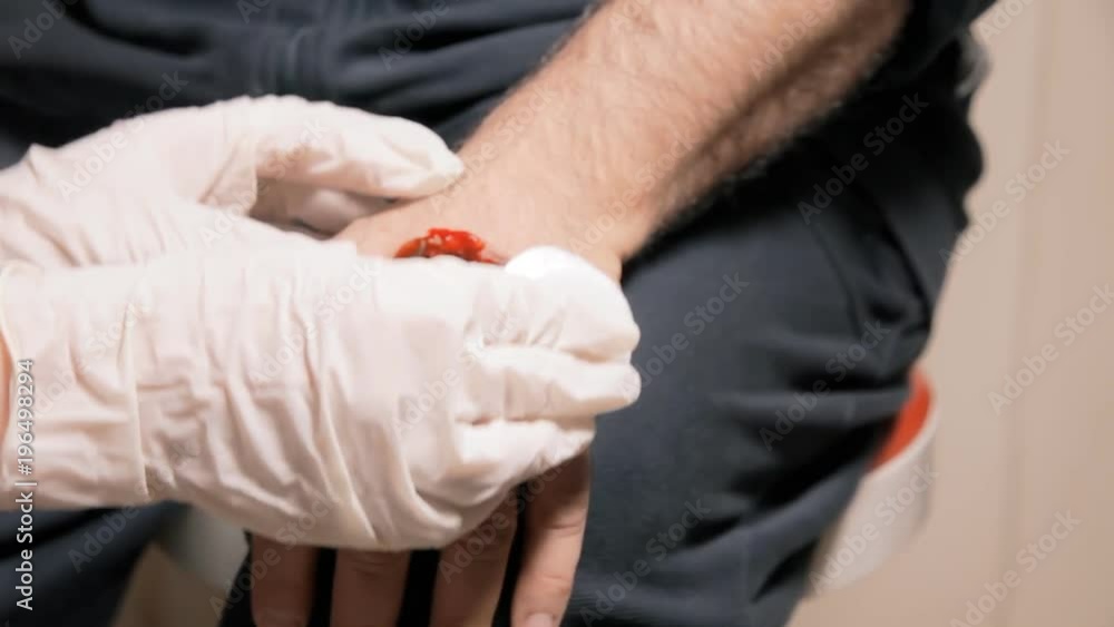 A doctor or nurse cleaning a bad bleeding wound on the hand of a man, with wet cotton, and applying a patch.
A doctor or nurse cleaning a bad bleeding wound on the hand of a man, with wet cotton, and applying a patch.