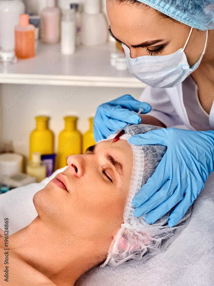 Filler injection for male face. Plastic facial surgery in beauty clinic. Man anti-aging therapy for complexion. Doctor in medical gloves with syringe forehead injects. Filler injection for male face. Plastic facial surgery in beauty clinic. Man anti-aging therapy for complexion. Doctor in medical gloves with syringe forehead injects.