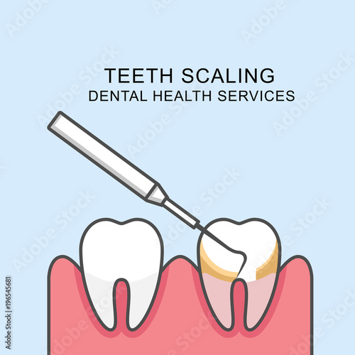 Teeth scaling icon - scaling tooth with periodontal probe