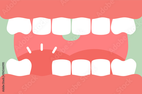 an open mouth with strong teeth and tongue and missing tooth