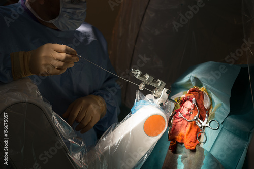 DEEP BRAIN STIMULATION