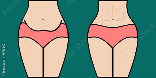 Before and after weight loss