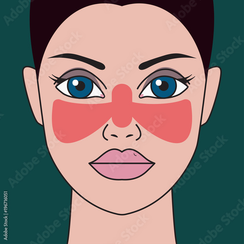 Systemic lupus erythematosus