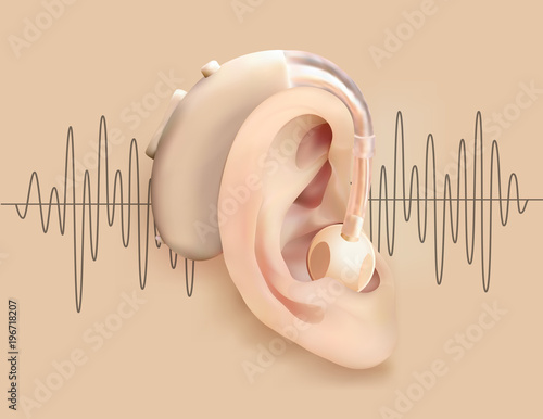 Hearing aid behind ear. Ear and sound amplifier on background of sound wave pattern. Deafness and hearing loss. Treatment and prosthetics in otolaryngology. Medicine realistic object. Vector