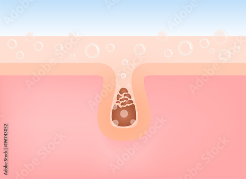 washing and cleaning acne from skin vector