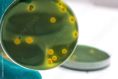 Closeup for plate Bacteria culture growth on Selective media, vibrio spp photo