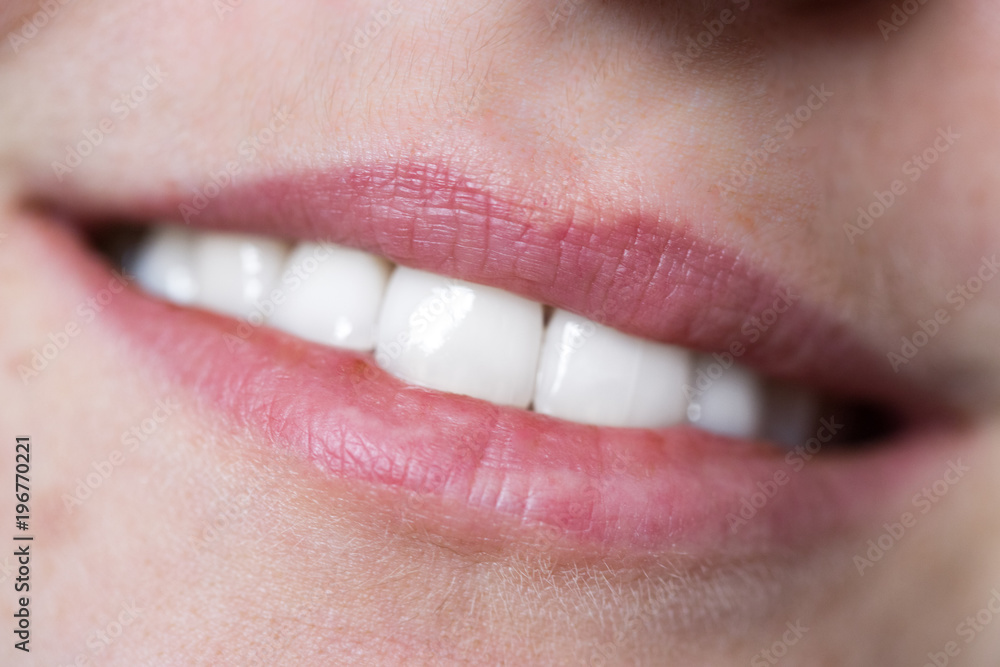 Naklejka premium Strahlend weiße gesunde Zähne und rote Lippen, Lächeln