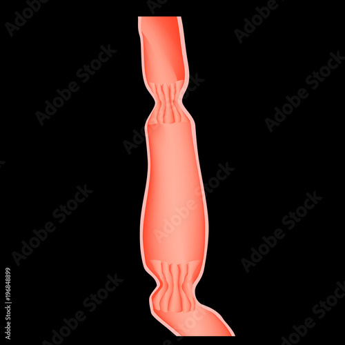 Upper sphincter of esophagus. Lower cardiac esophageal sphincter. Infographics. Vector illustration on black background.