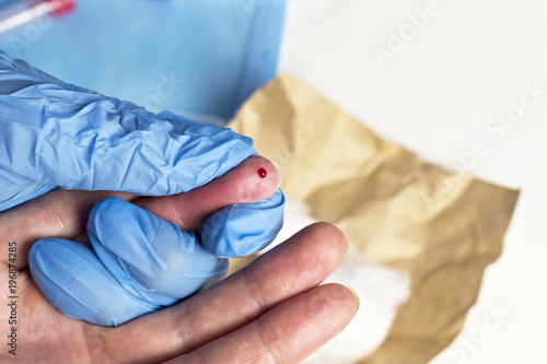 Fotografía .A doctor takes blood from a finger, close-up