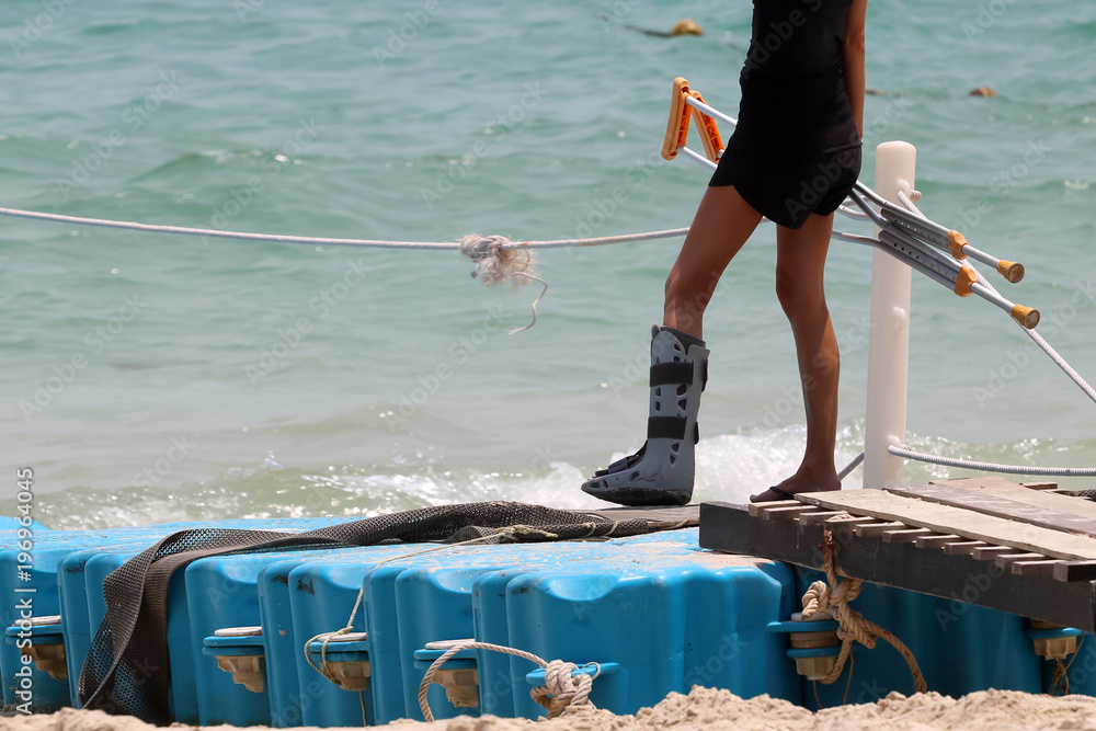 Φωτογραφία Accident tourist girl are walking up by crutches to the floating pier on the bea