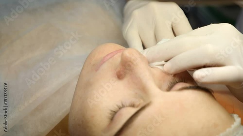 Beauty clinic. Beautician hands in gloves making face aging injection in a female skin. A woman gets beauty facial cosmetology procedure. Botox. collagen injections. Shot in 4k photo