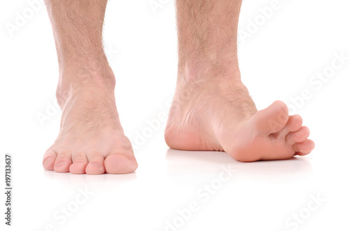 Feet itching. Infection of the feet caused by fungus.