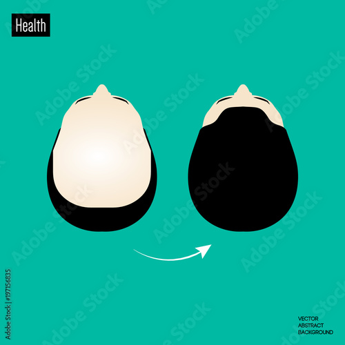 Hair loss. Hair treatment.