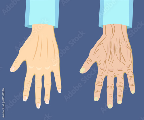 Two types of hand , old and young, vector illustration
