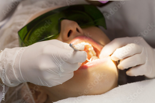 Fotografie Dentist doing a dental treatment on a patient