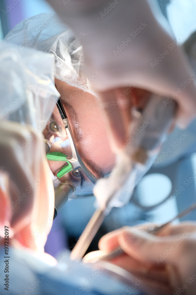 Fototapeta premium Female dentist in surgical uniform at the clinic while performing surgery for the patient