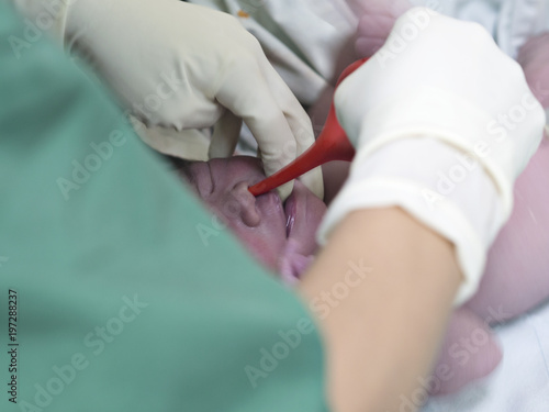 Pediatric doctor or hands wearing white sterile surgical gloves and doing suction for newborn baby using suction ball after natural or cesarean section birth in labour or nursery room at hospital