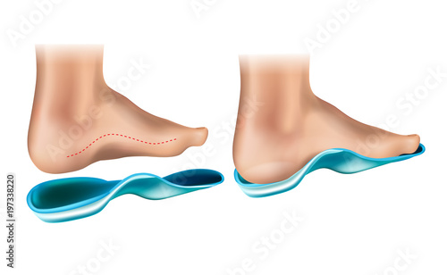 Orthopedic Insole.  Orthotic Arch Support