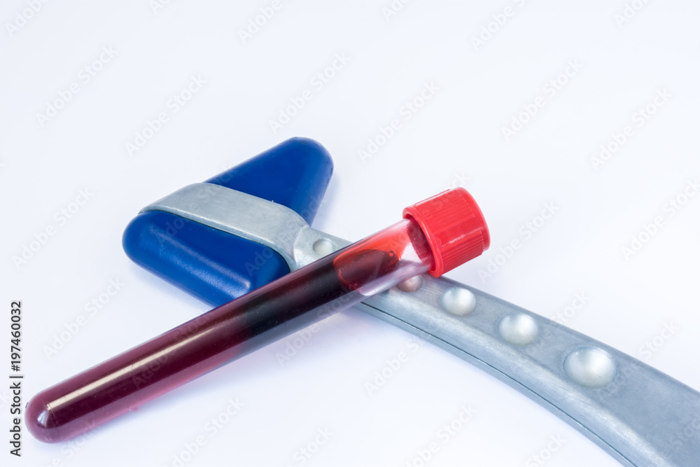 Laboratory test tubes with blood lying on the neurological rubber reflex hammer on a white background. Laboratory diagnosis for diseases of the human nervous system Laboratory test tubes with blood lying on the neurological rubber reflex hammer on a white background. Laboratory diagnosis for diseases of the human nervous system