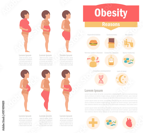 Obesity types and causes
