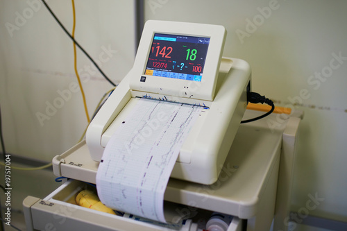 Photographie Cardiotocograph recording fetal heart rate