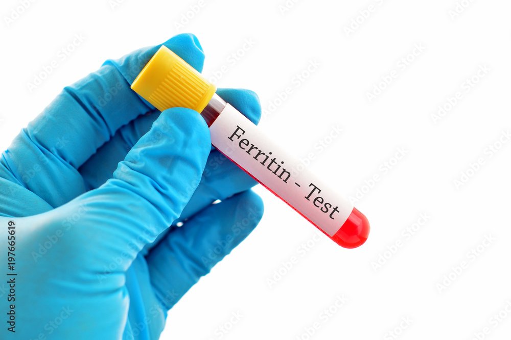Obraz premium Test tube with blood sample for ferritin test 