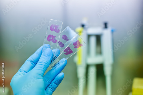 Hand in blue glove with histological rat liver, kidney an spleen tissue samples