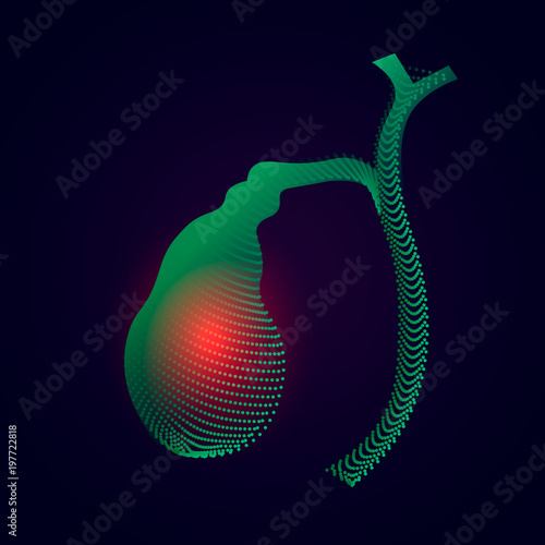 Gallbladder with a point of pain. Stylized transition from a real organ to an X-ray effect. Medical illustration of Gallbladder disease
