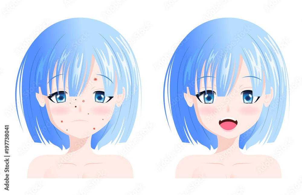 face with acne and without acne vector face with acne and without acne vector