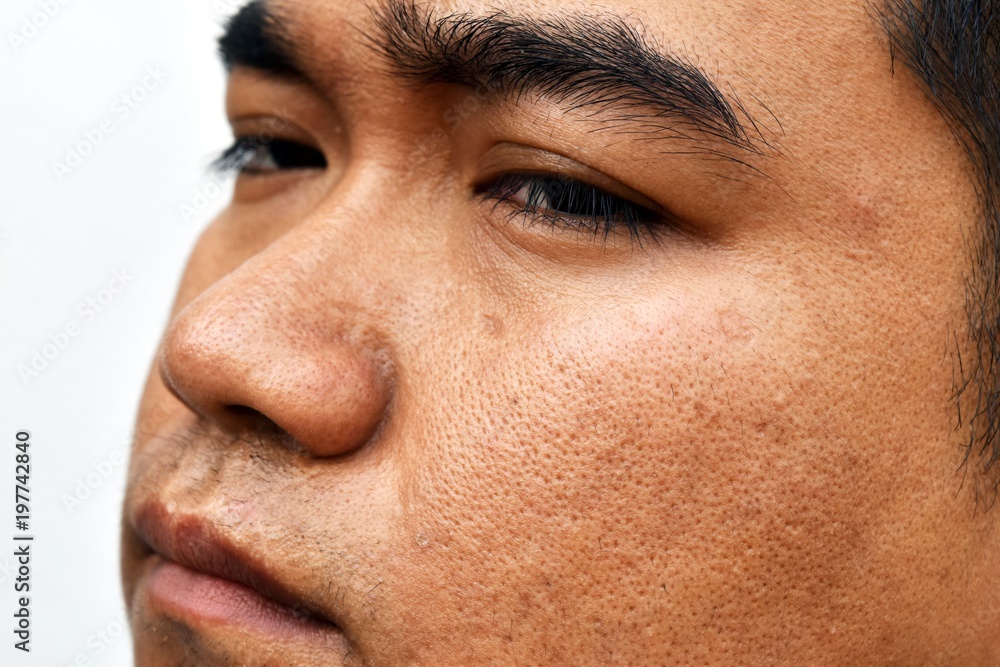 surface young asian man face skin after not get a wink of sleep and do not take care for a long time surface young asian man face skin after not get a wink of sleep and do not take care for a long time