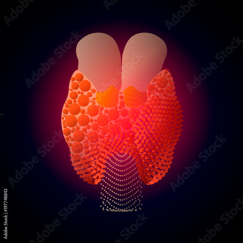 Thyroid with a point of pain. Stylized transition from a real organ to an X-ray effect. Medical illustration of Thyroid diseases