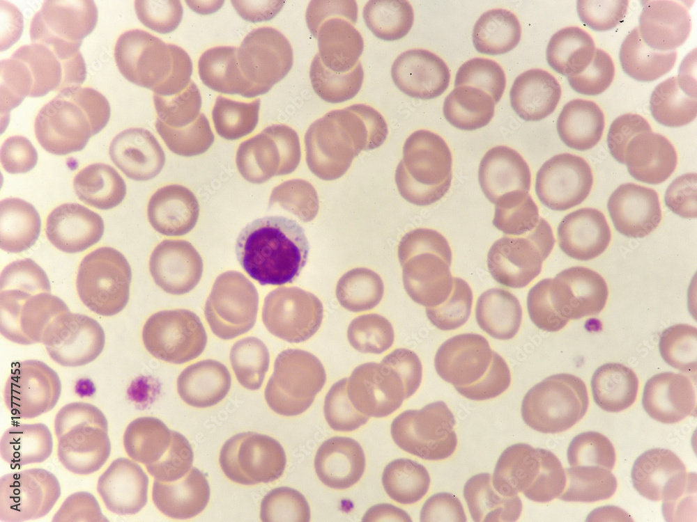 Lymphocyte cell (white blood cell) in blood smear, analyze by microscope