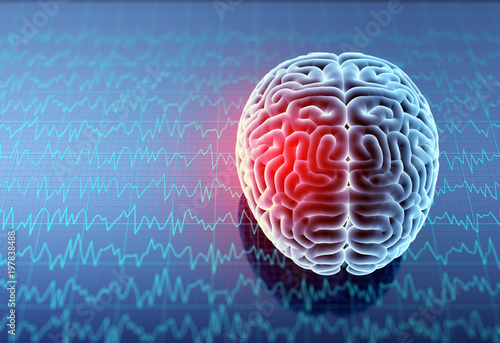 Headache area on brain X-ray, 3D illustration.