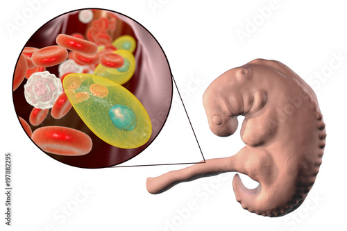 Transplacental transmission of Toxoplasma gondii parasites to human embryo, medical concept, 3D illustration photo