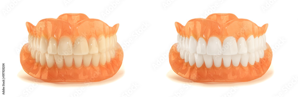 Full denture dentures close-up. Orthopedic dentistry with the use of modern technologies to restore teeth loss. The concept of aesthetic dentistry Full denture dentures close-up. Orthopedic dentistry with the use of modern technologies to restore teeth loss. The concept of aesthetic dentistry