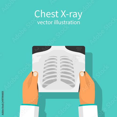 Chest X-ray. Doctor checking chest x-ray holding in hand. Medical research, analysis. Doctor checks. Vector illustration flat design. Isolated on white background. 