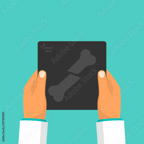 Doctor holding in hand x-ray image bone fracture. Vector illustration flat design. Medical exam and diagnosis. Healthcare concept. Radiology skeleton. Medical problem.