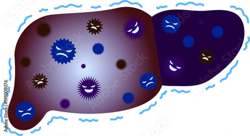 Unhealthy Liver illustration