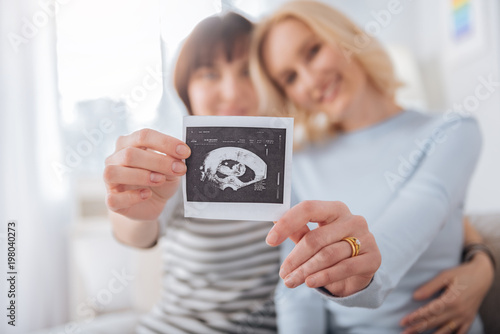 We are pregnant. Selective focus of an ultrasound photo being held by a joyful nice female couple