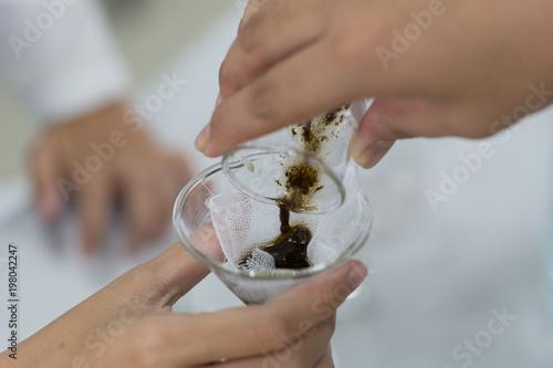 Finding parasites in feces in laboratory. photo