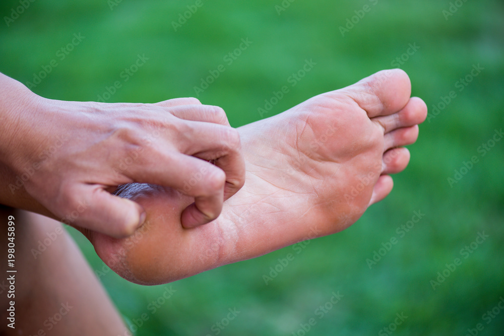 Close up woman hand scratch the itch by hand at home. Healthcare and medical concept. Close up woman hand scratch the itch by hand at home. Healthcare and medical concept.