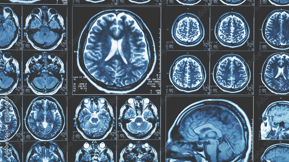 Mri brain scan background, magnetic resonance  tomography
