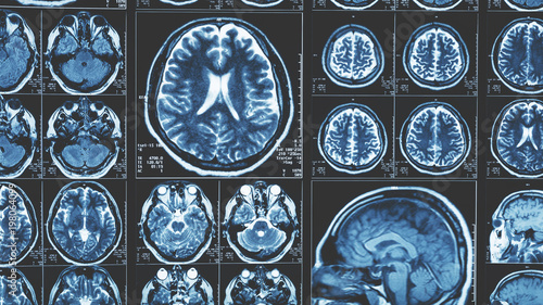 Mri brain scan background, magnetic resonance  tomography
