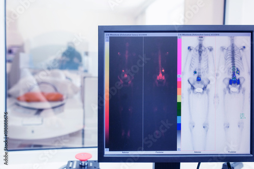 Fotografie isotope study in the laboratory of computed tomography