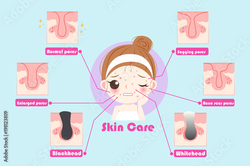 woman with skin care problem