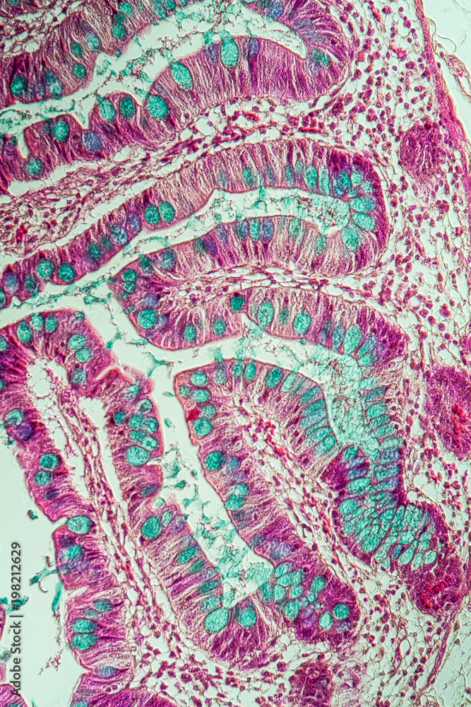 Dünndarm mit Darmzotten unter dem Mikroskop 200x Stock-Foto | Adobe Stock