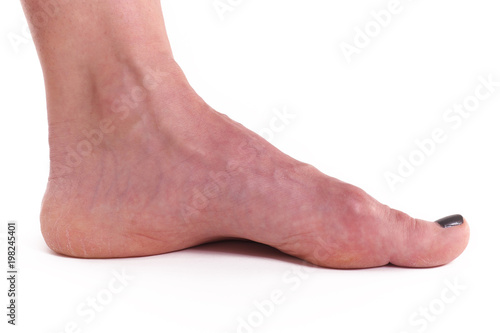Caucasian white healty female foot naked with red toe nails posing on white background