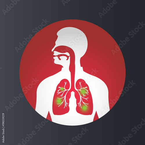 TUBERCULOSIS vector logo icon illustration