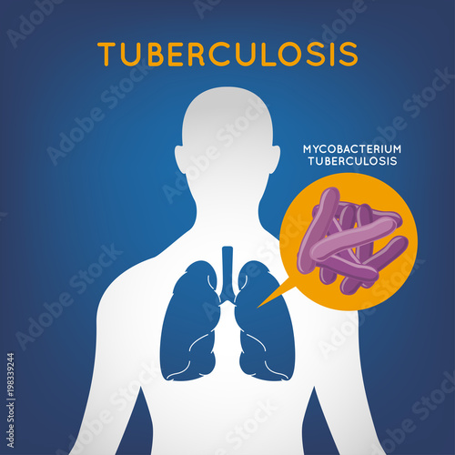 TUBERCULOSIS vector logo icon illustration
