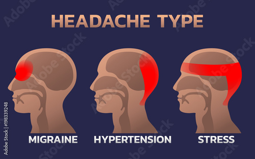 Types of Headaches Infographics design template, icon vector illustration